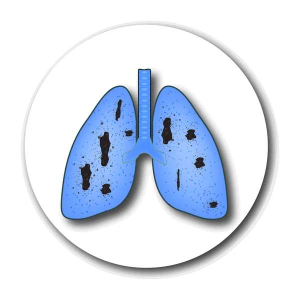 Tuberkulos. Emblem av Världsdagen för tuberkulos. 24 mars. Läkemedel, tabletter, kapslar. Strukturen i lungorna. Infographics. Vektorillustration på isolerade bakgrund. — Stock vektor