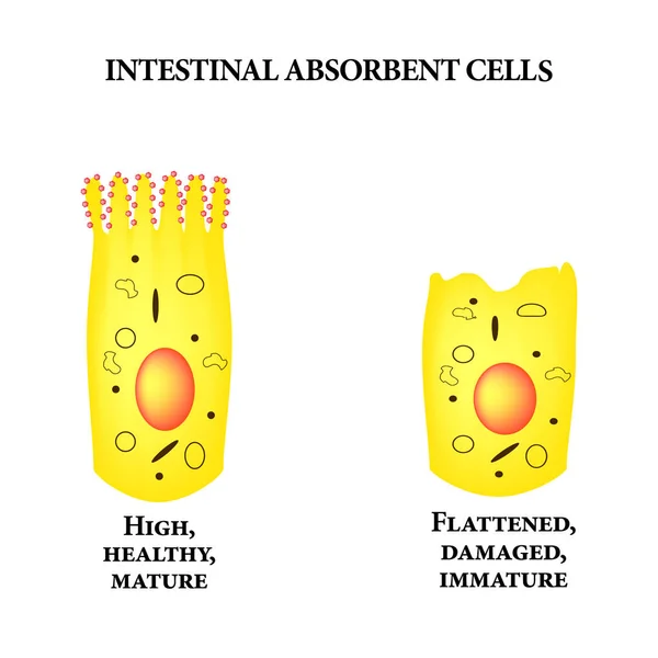Estructura del enterocito. Una celda deformada y enferma. células absorbentes intestino. Infografías. Ilustración vectorial sobre fondo aislado . — Vector de stock