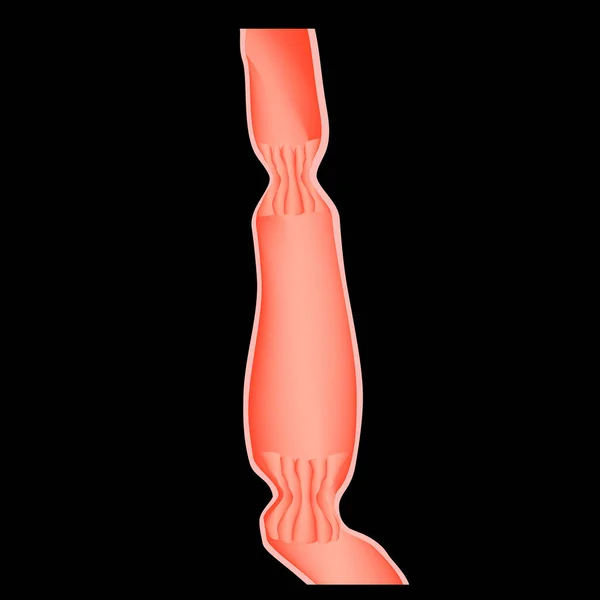 Bovenste sfincter van slokdarm. Lagere cardiale esophageal sfincter. Infographics. Vectorillustratie op zwarte achtergrond. — Stockvector