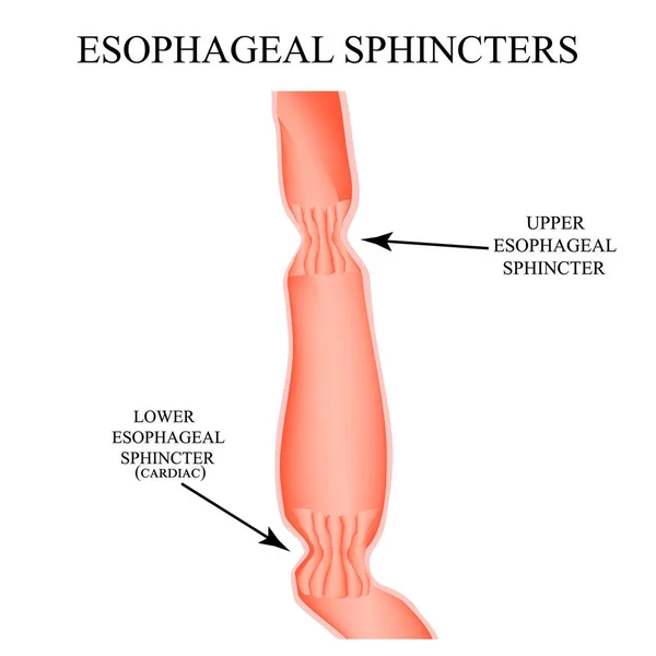 Övre sphincter av matstrupen. Lägre hjärt matstrupen sphincter. Infographics. Vektorillustration på isolerade bakgrund. — Stock vektor