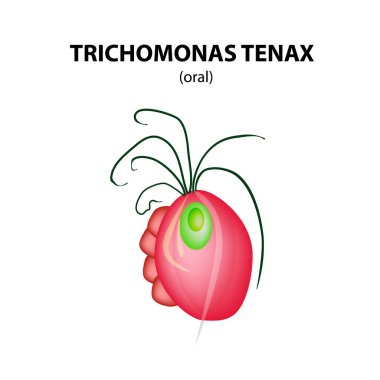 Oral Trichomonas structure. Trichomoniasis. Urogenital infection. Infographics. Vector illustration on isolated background. clipart