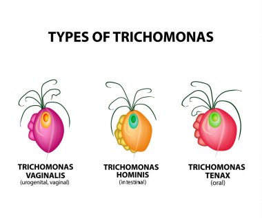 Türleri Trichomonads. Bağırsak, oral, vajinal Trikomonas yapısı. Trichomoniasis. İdrar enfeksiyonu. Infographics. Vektör illüstrasyon izole arka plan üzerinde.