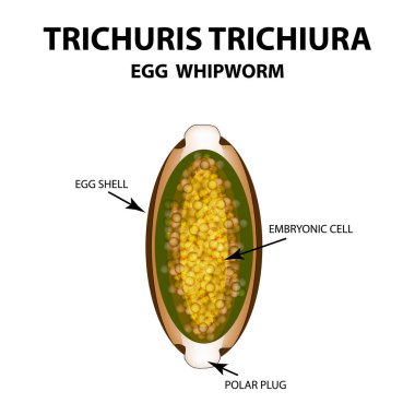 Yumurta whipworm. Trichuris. Infographics. Vektör illüstrasyon izole arka plan üzerinde.