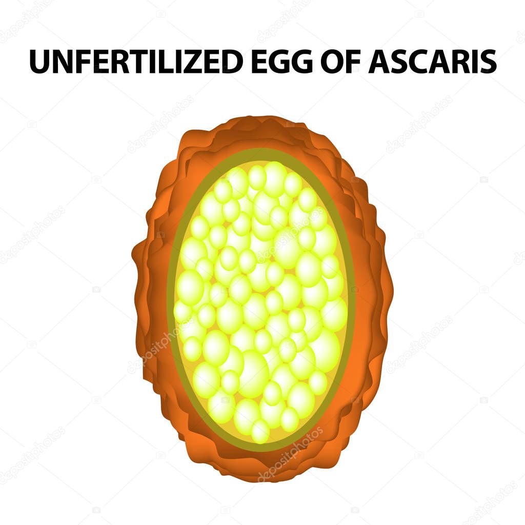 The egg of the roundworm unfertilized. Structure of Ascaris eggs. infographics. Vector illustration on isolated background.