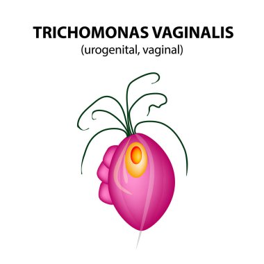 Trikomonas Vajinalis yapısı. Trichomoniasis. İdrar enfeksiyonu. Infographics. Vektör illüstrasyon izole arka plan üzerinde.