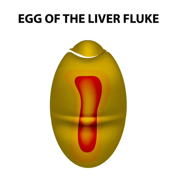 Ovo do verme do fígado. infográficos. Ilustração vetorial sobre fundo isolado . — Vetor de Stock