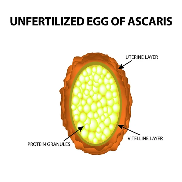El huevo de la lombriz sin fertilizar. Estructura de huevos de Ascaris. infografías. Ilustración vectorial sobre fondo aislado . — Vector de stock
