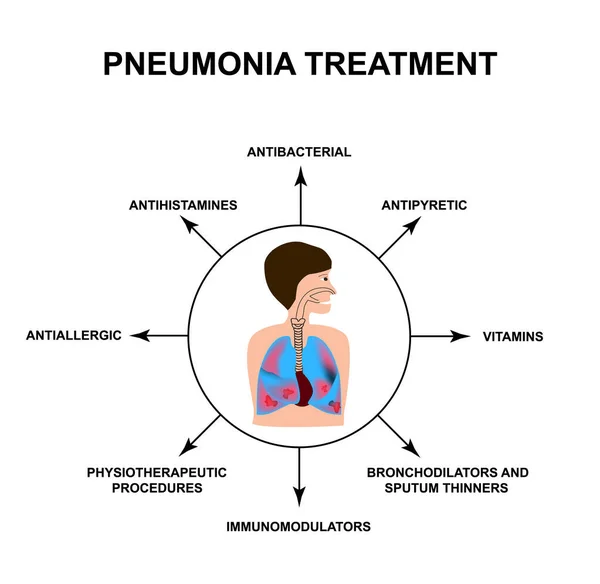 O tratamento da pneumonia. Órgãos respiratórios. Dia Mundial da Pneumonia. A estrutura anatômica dos pulmões inflamados. Infográficos. Ilustração vetorial sobre fundo isolado . —  Vetores de Stock