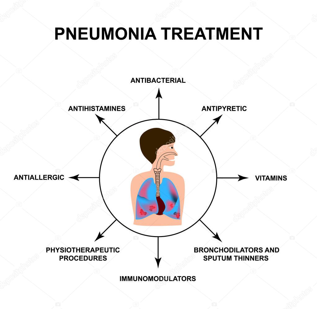 The treatment of pneumonia. Human respiratory organs. World Pneumonia Day. The anatomical structure of inflamed lungs. Infographics. Vector illustration on isolated background.