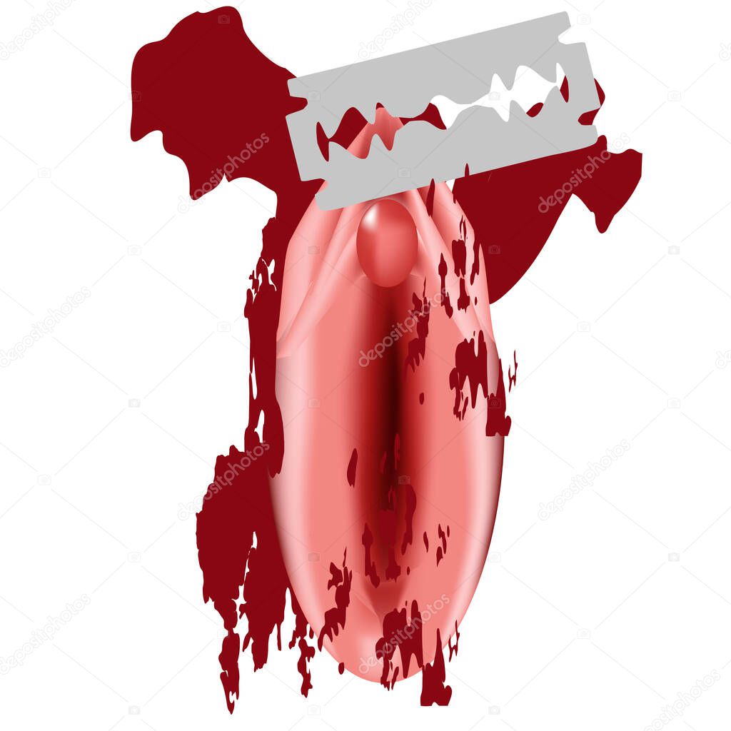 International Day of Zero Tolerance for Female Genital Mutilation. Female external genitalia. The vulva blade cuts. Female circumcision. Circumcision of the vulva and clitoris in Muslims. Vector