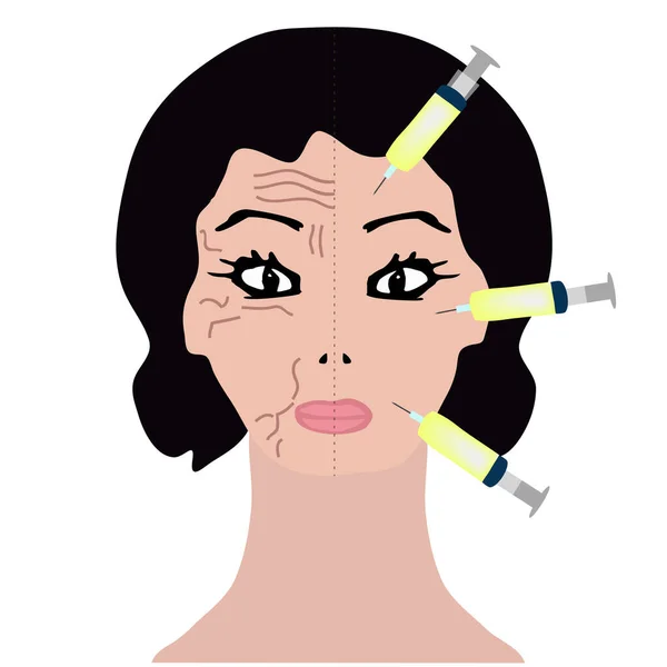 Keriput di salah satu setengah wajah. Pengobatan Botox. Suntik Botox. Infografis. Ilustrasi vektor pada latar belakang terisolasi . - Stok Vektor