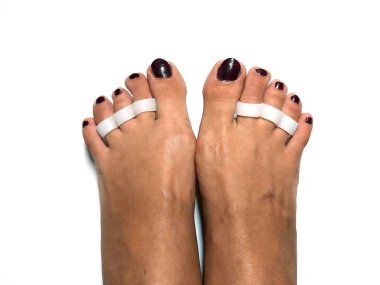 Ayak parmakları rektörü Silicone Valgus Büyük Şişik Kıymık Düzleştirici Ayak. Ortopedik için silikon desteği.