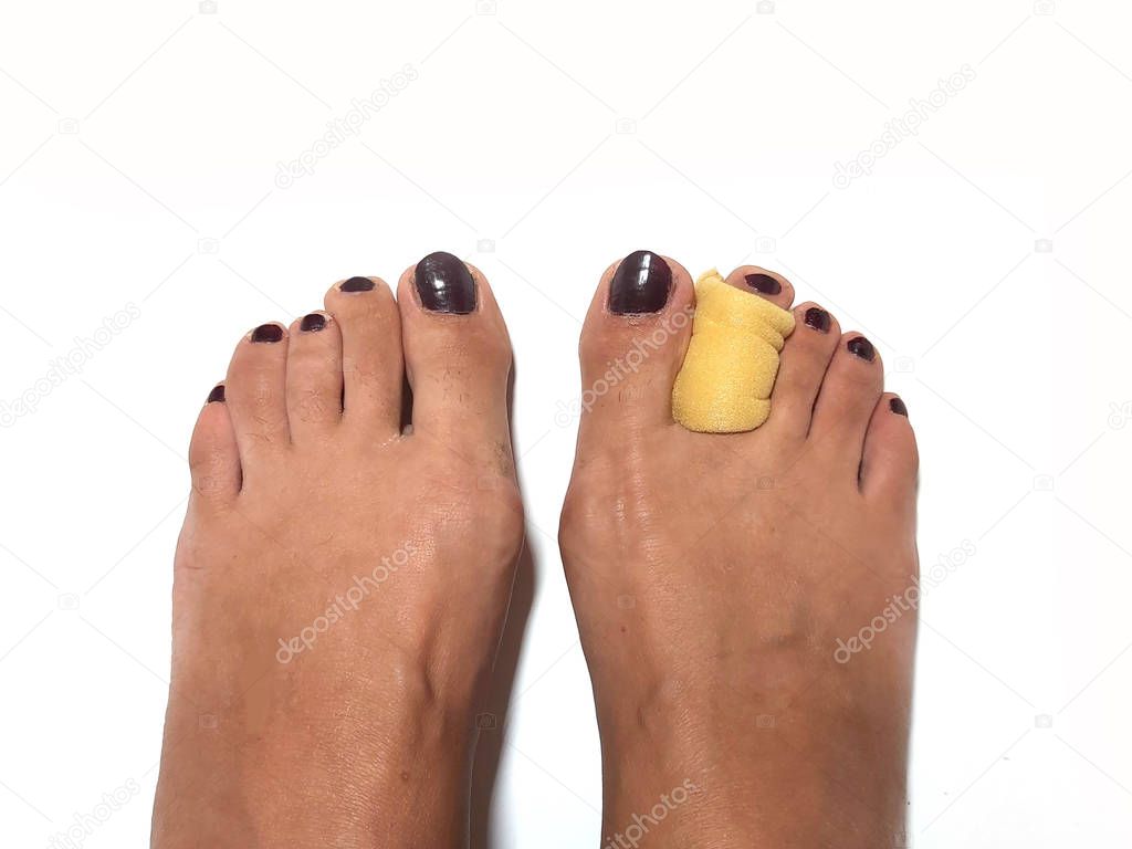 Toe Corrector Silicone Valgus Big Bunion Splint Straightener Foot. silicone support for orthopedic.