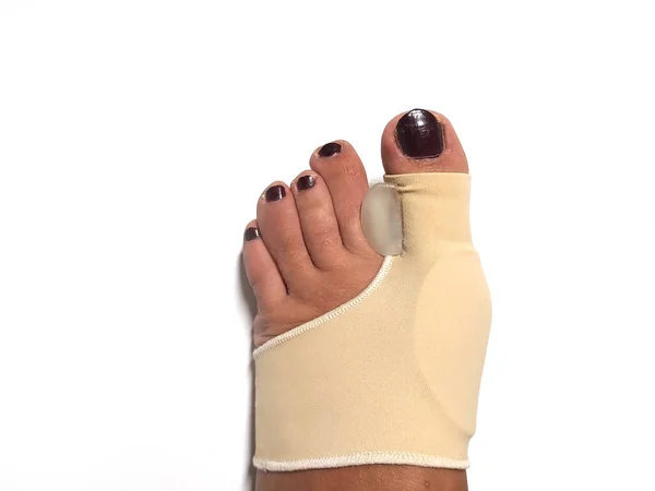 Toe Corrector Silicone Valgus Big Bunion Splint Rovnačka nohou. silikonová podpora pro ortopedii. — Stock fotografie