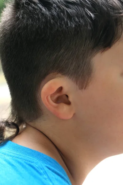 Deformação da orelha. Forma irregular da aurícula . — Fotografia de Stock
