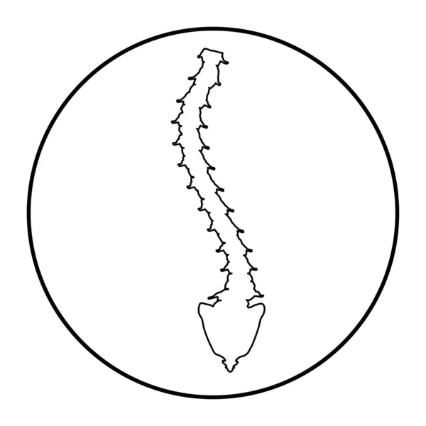 Lineare Silhouette Ikone Skoliose. Wirbelsäulenverkrümmung, Kyphose, Lordose des Halses, Skoliose, Arthrose. Fehlhaltung und Verbeugung. Infografik Vektorillustration auf isoliertem Hintergrund. — Stockvektor