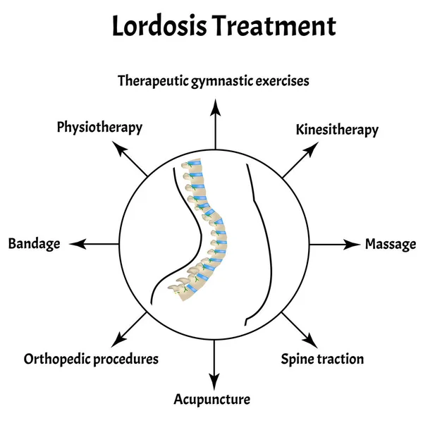 Treatment of lordosis. Spinal curvature, kyphosis, lordosis, scoliosis, arthrosis. Improper posture and stoop. Infographics. Vector illustration on isolated background. — Stock Illustration Treatment of lordosis. Spinal curvature, kyphosis, lordosis, scoliosis, arthrosis. Improper posture and stoop. Infographics. Vector illustration on isolated background. Vector Graphics