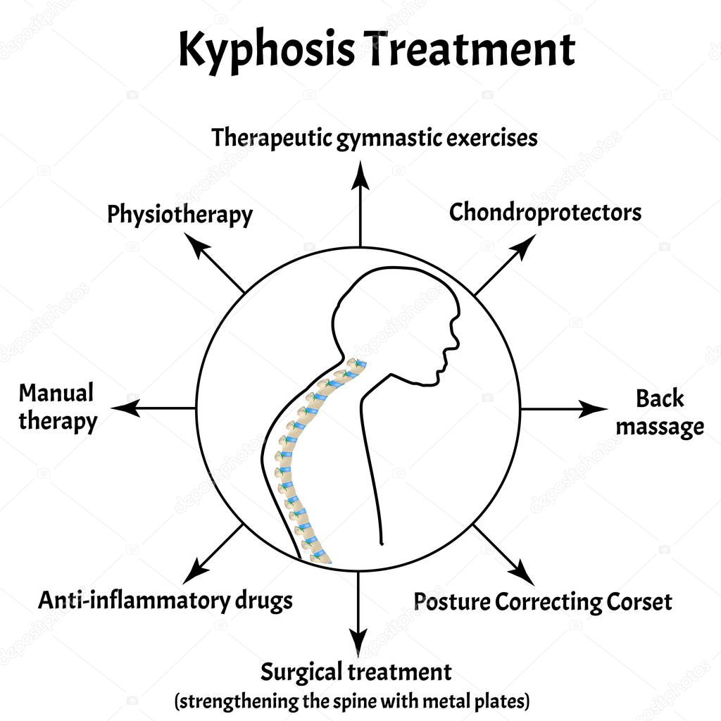 Kyphosis treatment. Spinal curvature, kyphosis, lordosis, scoliosis, arthrosis. Improper posture and stoop. Infographics. Vector illustration on isolated background.