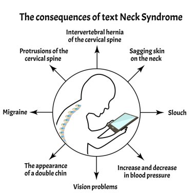 Consequences of Text Neck Syndrome. Spinal curvature, kyphosis, lordosis of the neck, scoliosis, arthrosis. Improper posture and stoop. Infographics. Vector illustration on isolated background clipart