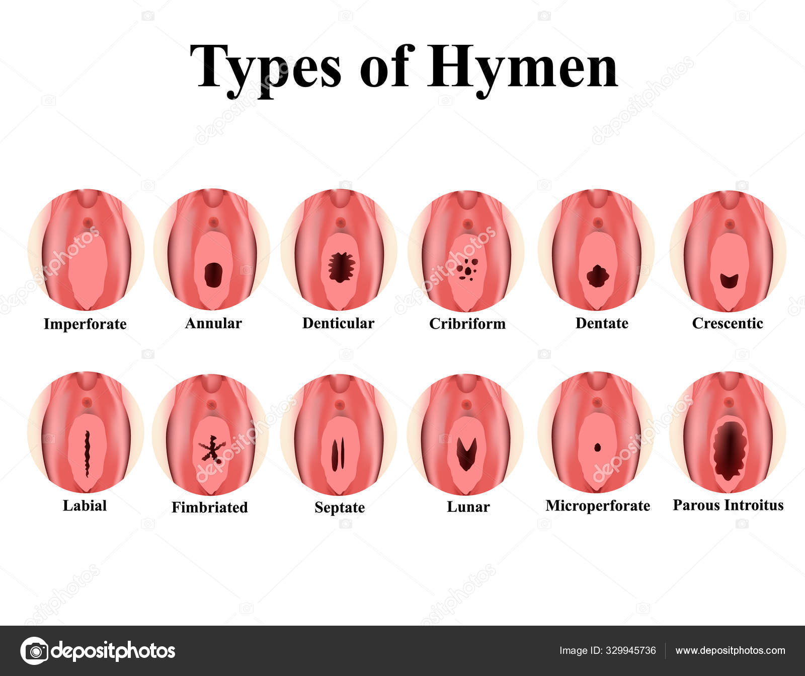 Vektorgrafiken Hymen Vektorbilder Hymen Depositphotos Vektorgrafiken Hymen Vektorbilder Hymen Depositphotos