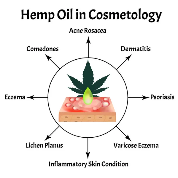 Óleo de maconha em cosmetologia. Ícones de maconha cbd. Logotipo de canabinóide. Folhas de maconha. Óleo de cânhamo. Infográficos. Ilustração vetorial sobre fundo isolado . — Vetor de Stock