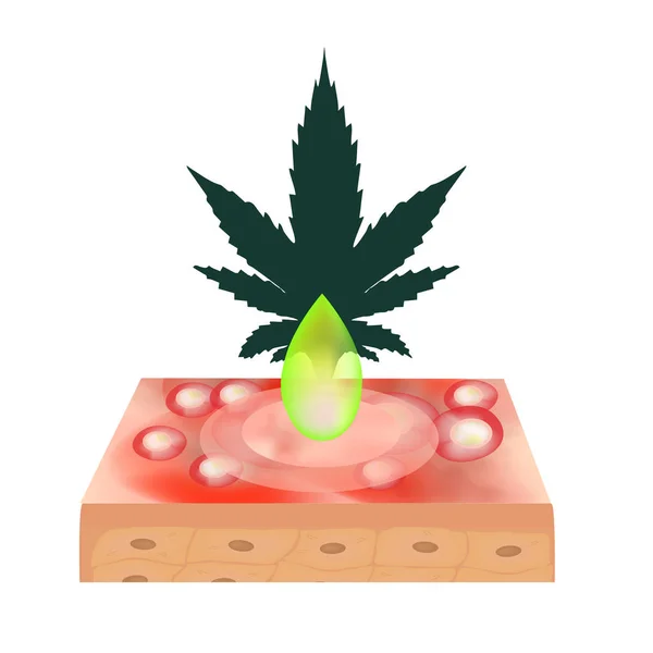 Huile de marijuana en cosmétologie. Icônes de marijuana cbd. Logo cannabinoïde. Feuilles de marijuana. Huile de chanvre. Infographie. Illustration vectorielle sur fond isolé . — Image vectorielle