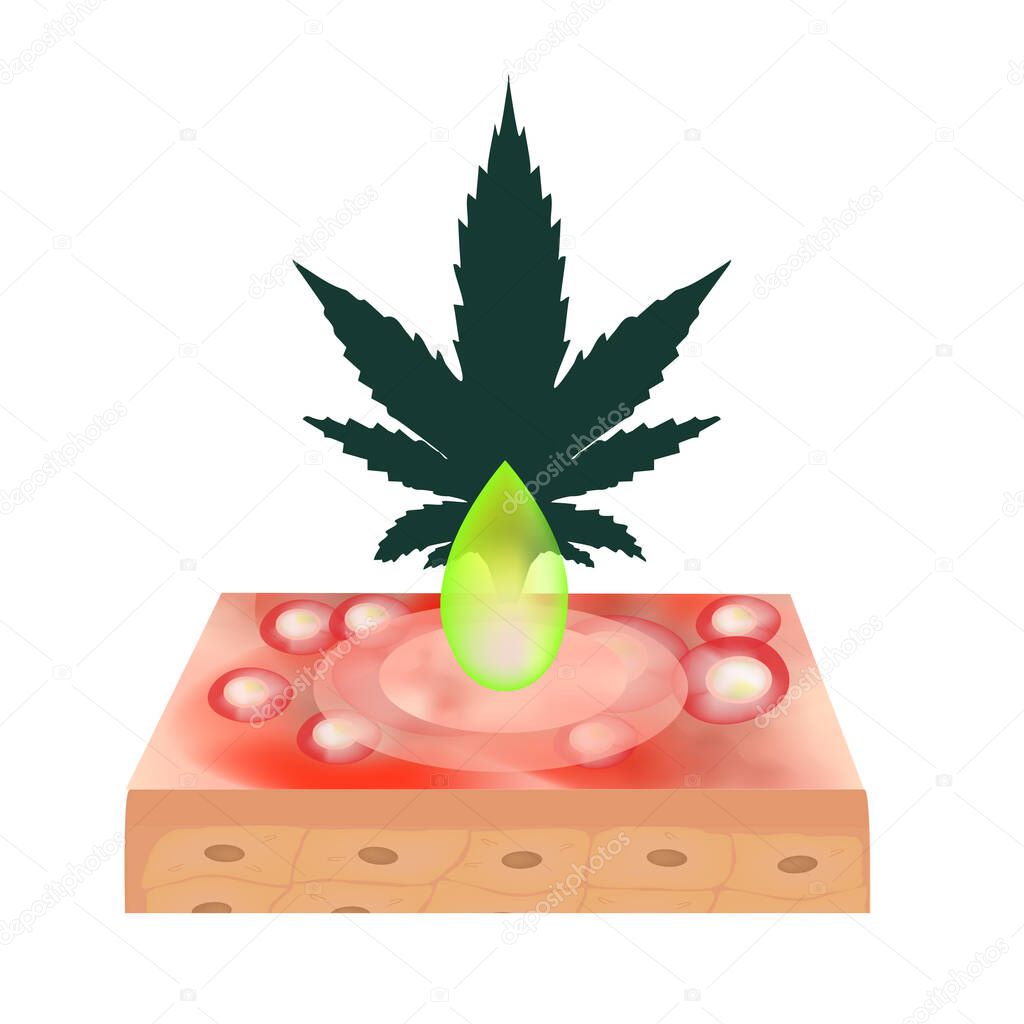 Marijuana oil in cosmetology. Marijuana icons cbd. Cannabinoid logo. Marijuana Leaves. Hemp oil. Infographics. Vector illustration on isolated background.