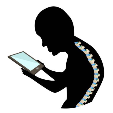 Text Neck Syndrome. Spinal curvature, kyphosis, lordosis of the neck, scoliosis, arthrosis. Improper posture and stoop. Black and white silhouette icon. Infographics. Vector illustration. clipart