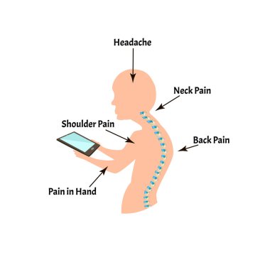 Uygunsuz duruş belirtileri. Metin Boyun Sendromu. Omurga eğriliği, kifoz, lordosis, skolyoz, artrosis. Uygunsuz duruş ve eğilme. Bilgi grafikleri. İzole edilmiş arkaplanda vektör illüstrasyonu.