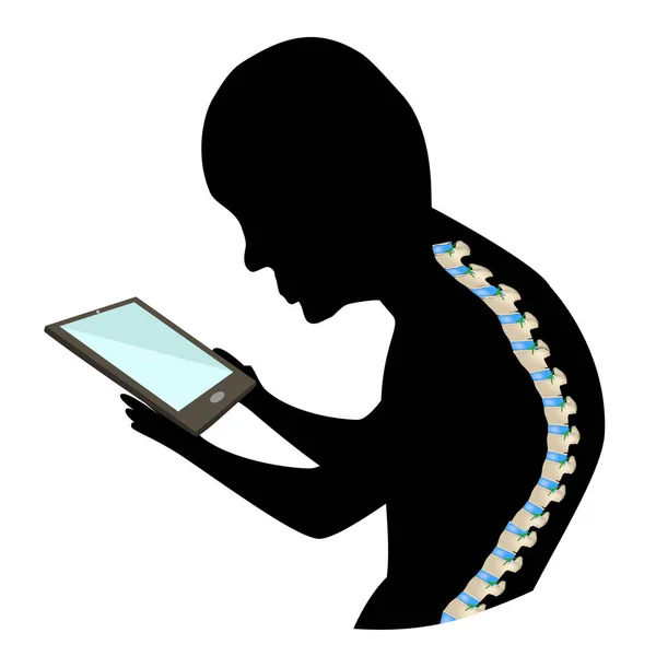 Text Neck Syndrome. Spinal curvature, kyphosis, lordosis of the neck, scoliosis, arthrosis. Improper posture and stoop. Black and white silhouette icon. Infographics. Vector illustration. — 스톡 벡터