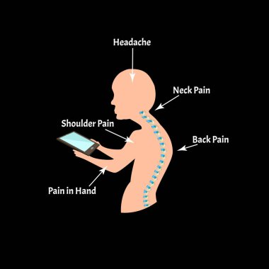 Uygunsuz duruş belirtileri. Metin Boyun Sendromu. Omurga eğriliği, kifoz, lordosis, skolyoz, artrosis. Uygunsuz duruş ve eğilme. Bilgi grafikleri. Vektör illüstrasyonu.