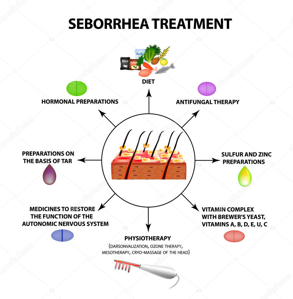 Treatment of seborrhea. Seborrhea skin and hair. Dandruff, seborrheic dermatitis. Baldness, hair growth, baldness. Anatomical structure. Infographics. Vector illustration on isolated background.