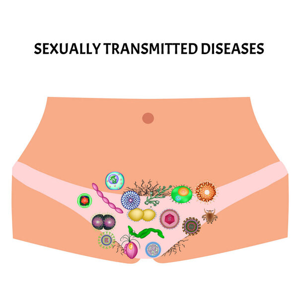 Viral and bacterial infections. Sexually transmitted diseases. Infographics. Vector illustration on isolated background.