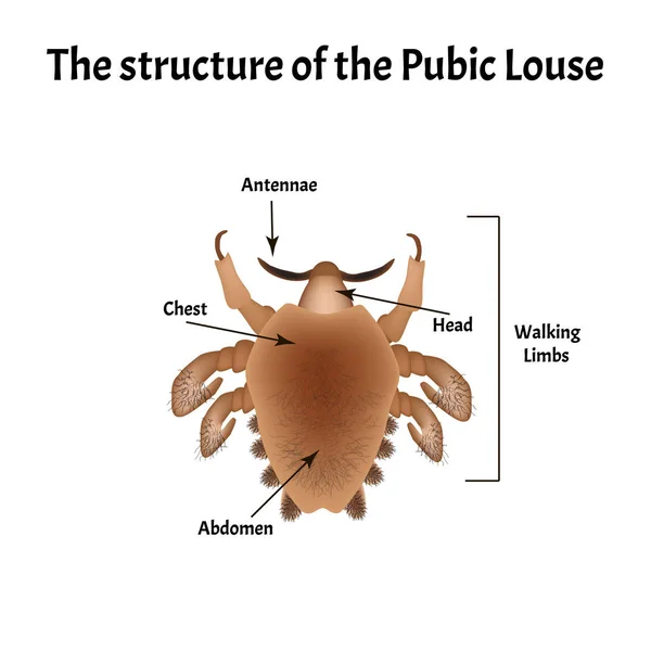 Паразитарные заболевания Фтириаза. Педикулёз лобковый. Структура лобковых вшей. Заболевания, передающиеся половым путем. Инфографика. Векторная иллюстрация на изолированном фоне . — стоковый вектор
