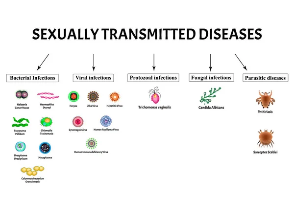 Szia, herpesz, papillóma, hepatitis, cytomegalovírus, Zika. Állítson be vírusfertőzéseket. Szifilisz, Gonococcus, Chlamydiosis, Chlamydia, Mycoplasma, Ureaplasma Bakteriális. Szexuális úton terjedő betegségek. Vektor — Stock Vector