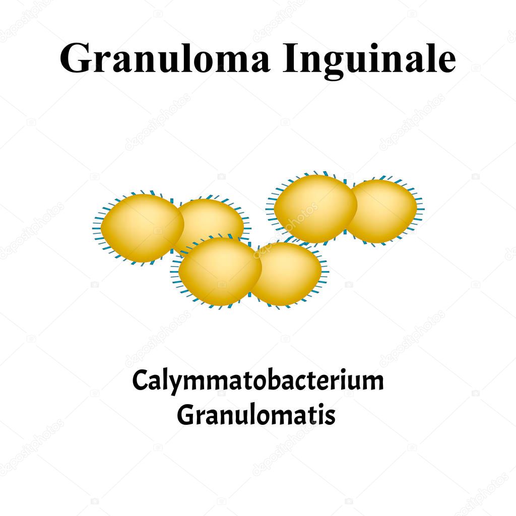 Inguinal granuloma. Bacterial infections. Sexually transmitted diseases. Infographics. Vector illustration on isolated background.