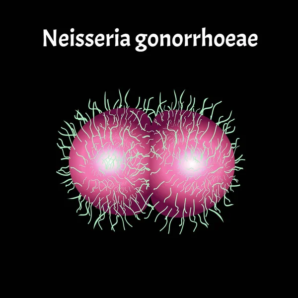 Estrutura Gonococcus. Neisseria gonorrhoeae. Doença da gonorreia. Doença venérea. Infográficos. Ilustração vetorial . —  Vetores de Stock