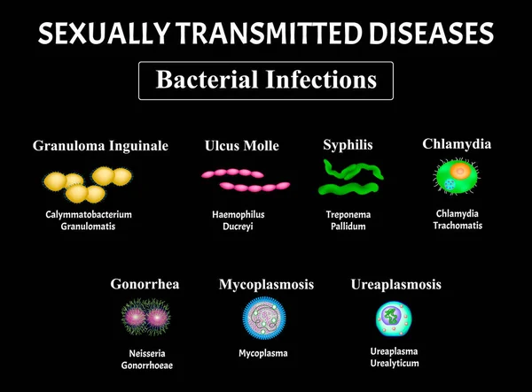 Szifilisz, spirochaete, Treponema, Gonococcus, Gonorrhea, Chlamydiosis, Chlamydia, Mycoplasma, Ureaplasma Bakteriális fertőzés készlet. Szexuális úton terjedő betegségek. Infografikák. Vektorillusztráció — Stock Vector