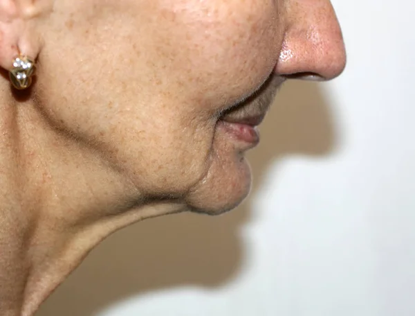 Носогубные морщины. Морщины на коже лица шеи. Гладкие щеки и шея — стоковое фото
