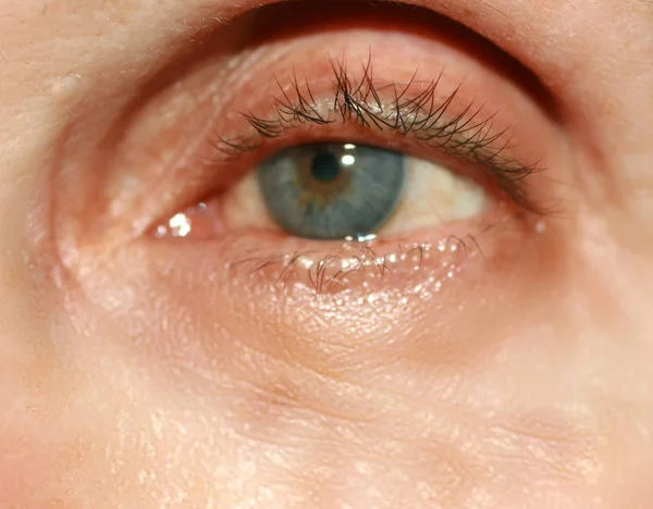 Arrugas debajo de los ojos. Arrugas en la piel de la cara. Párpados flácidos — Foto de Stock