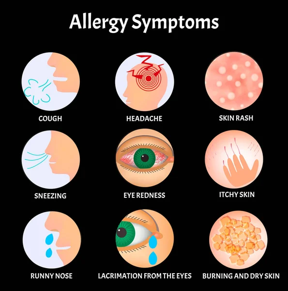 Συμπτώματα Αλλεργιών Δερματικό εξάνθημα, Αλλεργική κνησμός δέρματος, Σκίσιμο από τα μάτια, Βήχας, Φτερνίζει, Τρέχει μύτη, Πονοκέφαλος, Ερυθρότητα των ματιών. αλλεργία Infographics. Εικονογράφηση διανύσματος. — Διανυσματικό Αρχείο