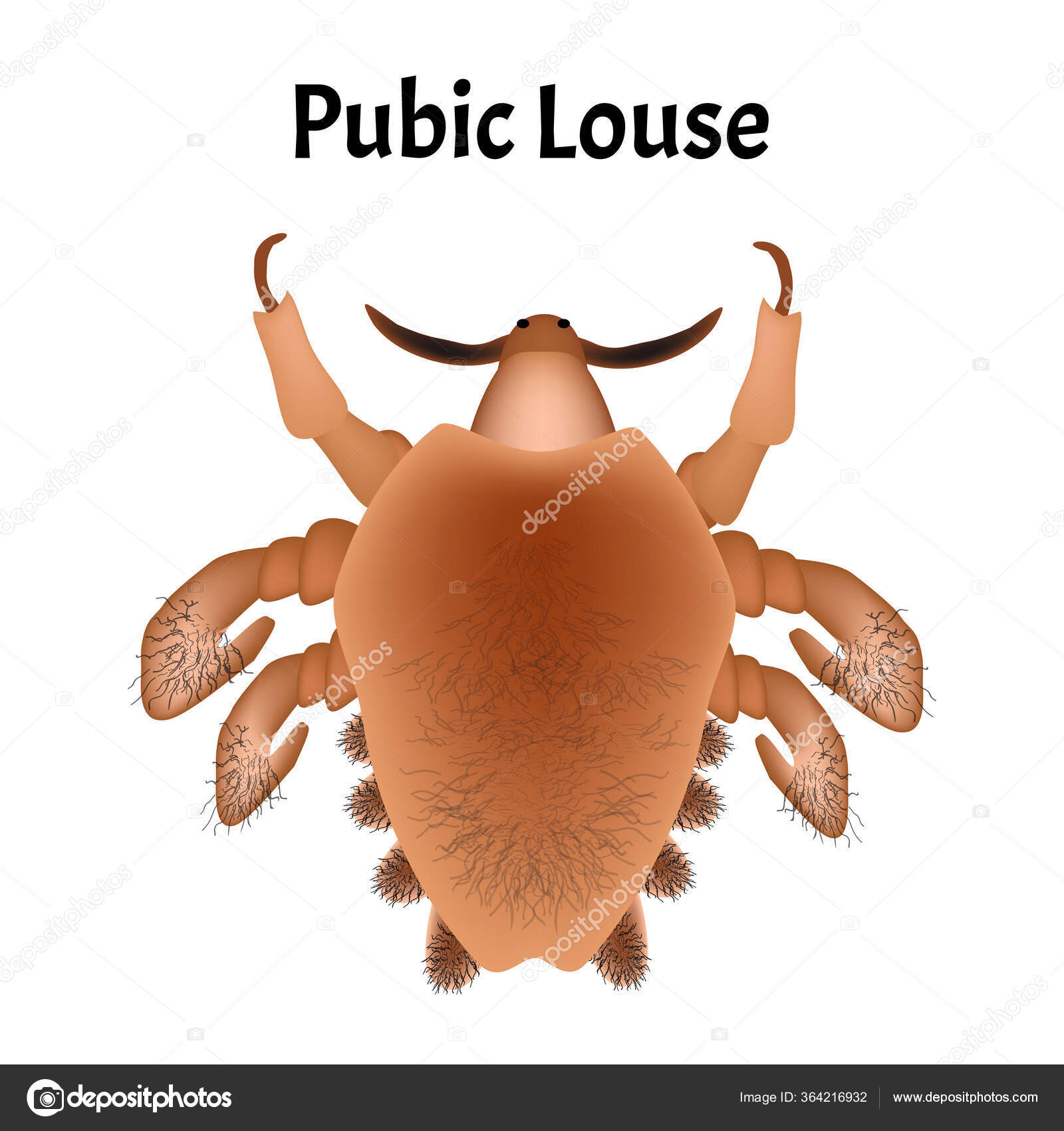 Pediculosis Pubis Crabs