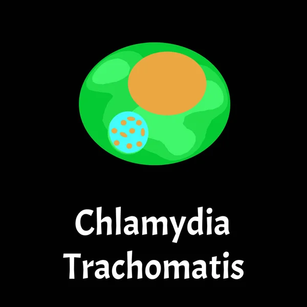 Chlamydia trachomatis. Bakteriális fertőzések Chlamydiosis. Szexuális úton terjedő betegségek. Infografikák. Vektorillusztráció izolált háttérrel. — Stock Vector