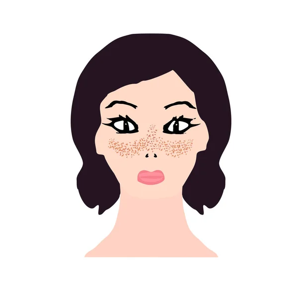 Pecas en la cara. Pigmentación en la piel. Mancha pigmentada en la piel de la cara. Antes y después del tratamiento. Ilustración vectorial — Archivo Imágenes Vectoriales