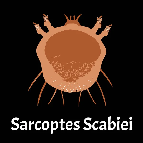 Sarcoptes scabiei. sarna. Enfermedades de transmisión sexual. Infografías. ilustración sobre fondo aislado . — Archivo Imágenes Vectoriales