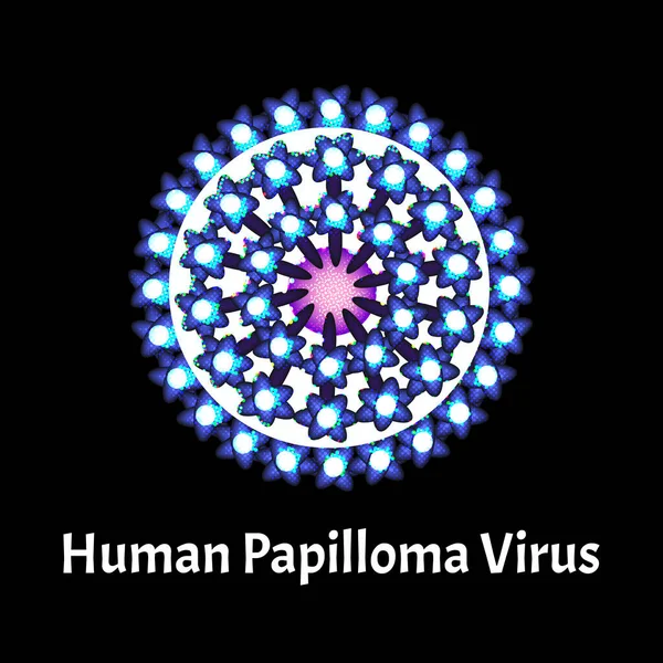 Папиллома это структура вируса человека. Вирусная инфекция папилломы. Заболевания, передающиеся половым путем. Инфографика. Векторная иллюстрация на изолированном фоне . — стоковый вектор