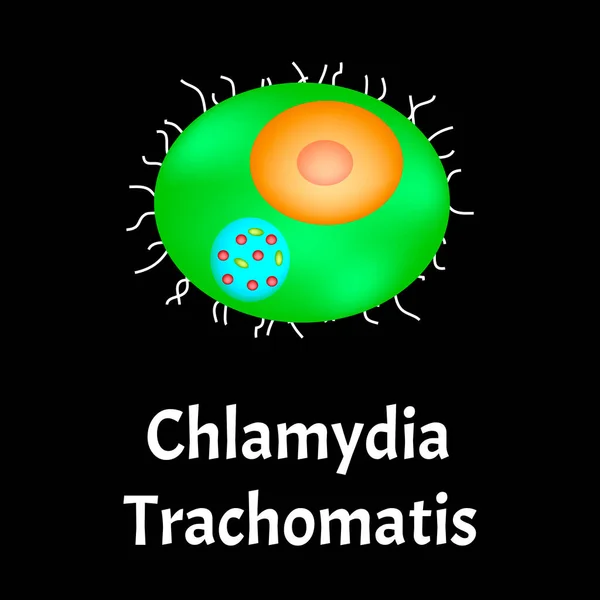 Chlamydia trachomatis. Infecciones bacterianas Clamidiosis. Enfermedades de transmisión sexual. Infografías. Ilustración vectorial sobre fondo aislado . — Vector de stock