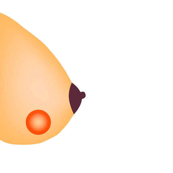 Abscess in the mammary gland. World Breast Cancer Day. Vector illustration on isolated background