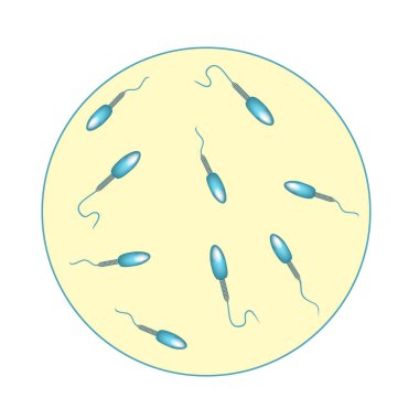 Sperm sayısı düşük. Boşalıktaki sperm miktarı çok azdı. Erkek kısırlığı Oligospermia. Spermogram. Patoloji tipleri. Sperm kusurları. Spermin yapısı. Bilgi Grafikleri Vektörü.