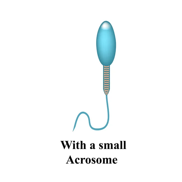 A sperma kóros formái az ejakulátumban. Férfi meddőség Oligospermia. Spermogram. Sperma rendellenességek. Infografikák. Vektorillusztráció izolált háttérrel. — Stock Vector